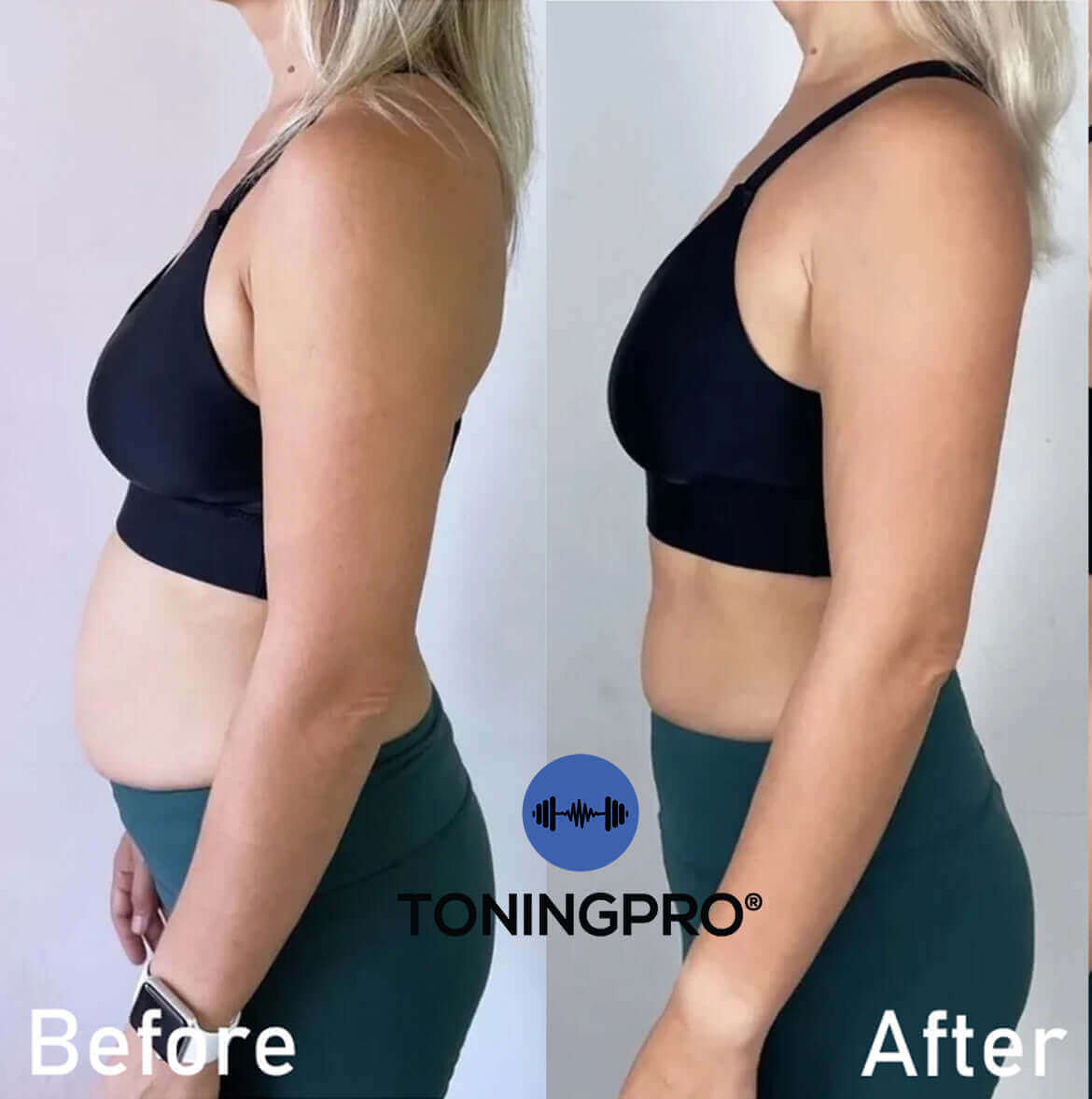 TONINGPRO® RESULTS