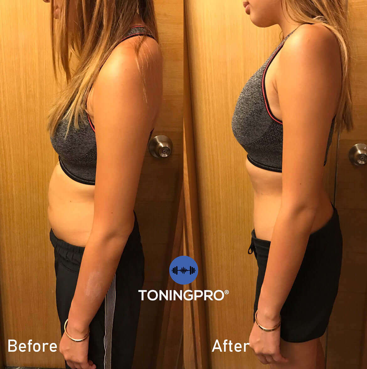 TONINGPRO® RESULTS