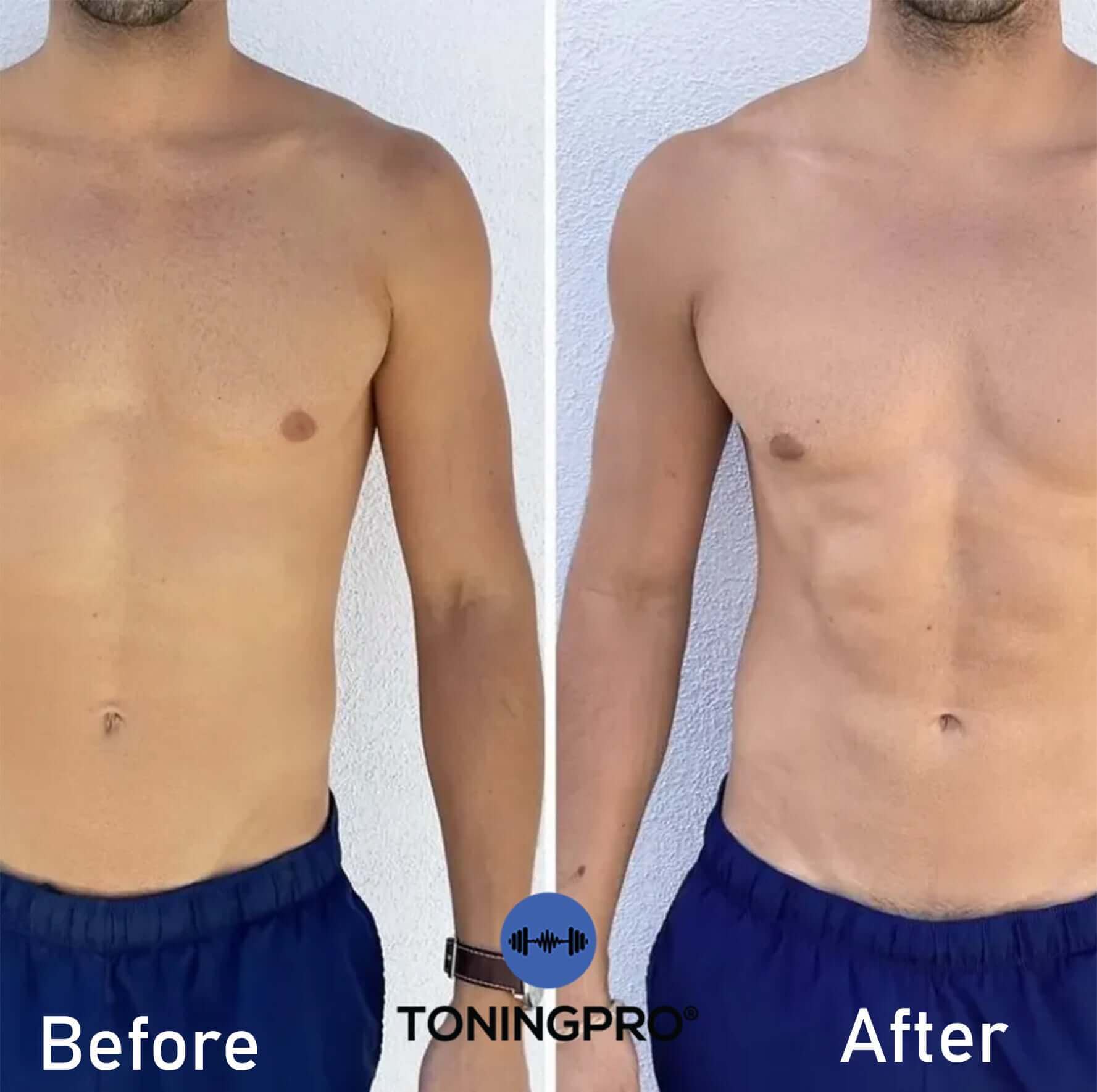 TONINGPRO®